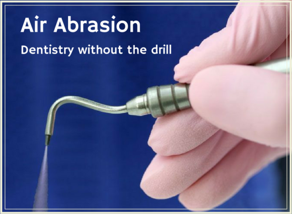 air abrasion - high park dentist toronto