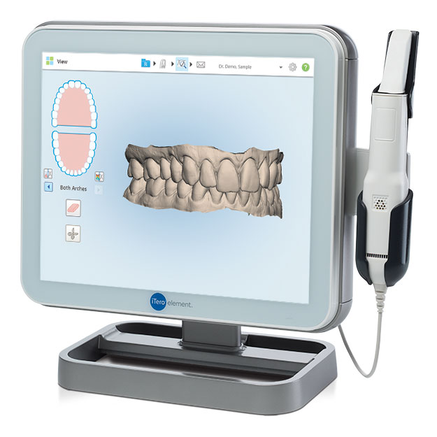 itero Digital dental impression high park